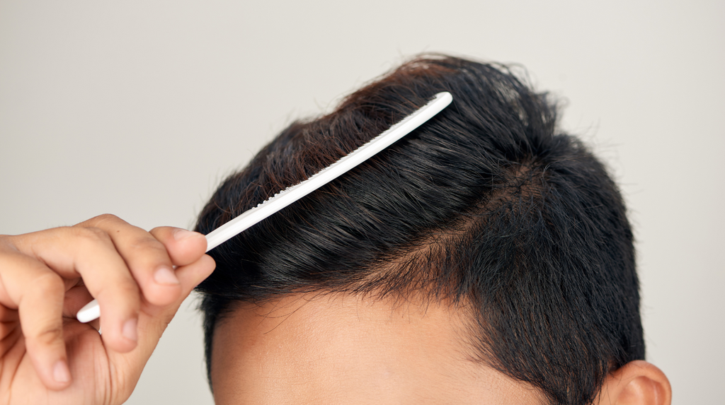 Exosome Hair Restoration in Toronto: A Treatment for Thinning Hair